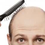 薄毛の悩みは専門家に相談した方が良い理由5つ